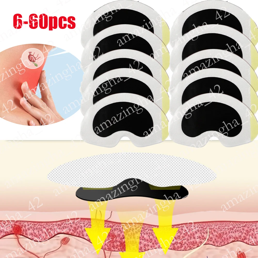 

6-60pcs Painless Treatment Breast Lymph Nodes Patch Organic Lymphatic Drainage Detox Patch Effective Anti-Swelling Patch