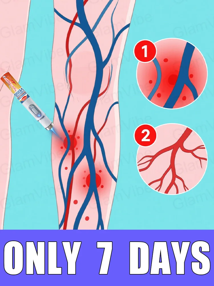 

blue light pen solve varicose veins, hot sale leg care tools