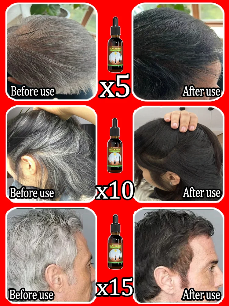 Turn white hair into black hair, naturally black hair, make you 20 years younger again, without side effects