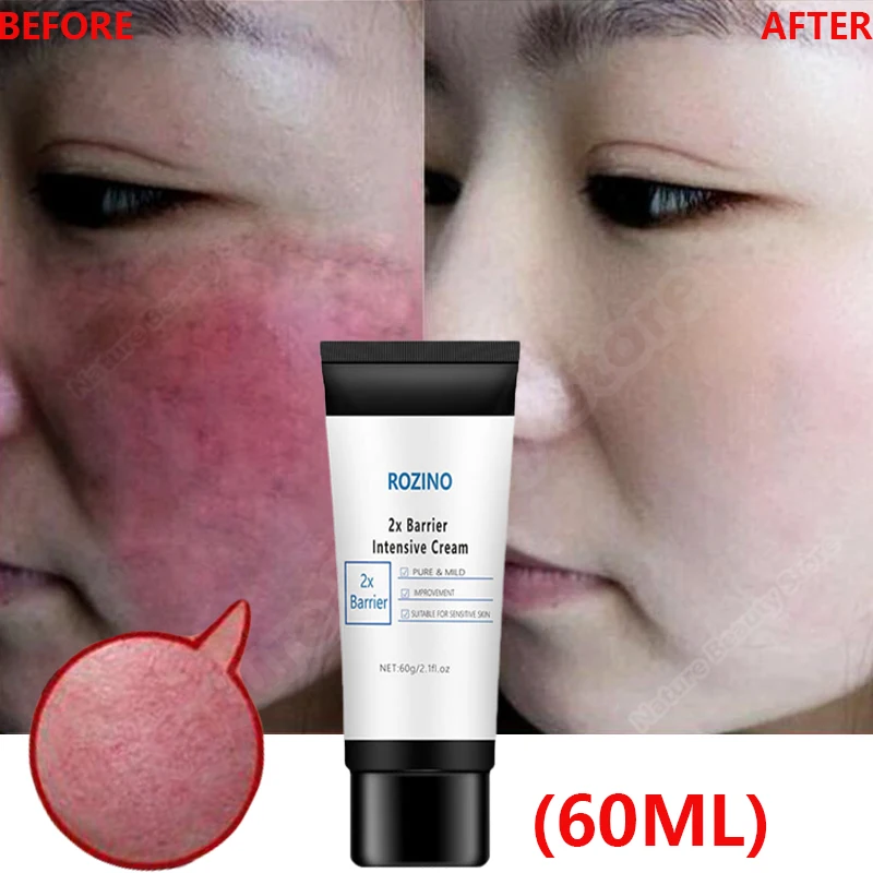 Facial Redness Repair Cream Improve Sensitive Skin Redness Rosacea Itching Instant Spider Vein Treatment Anti Aging Skin Care