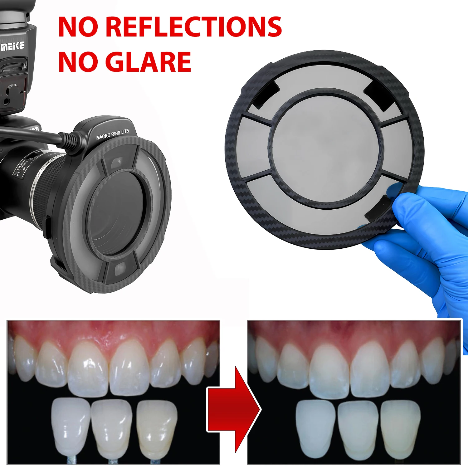 MEIKE Flash With Cross Polarizing Lens Filter For Dental Photography - No Glare, No Relfection Oral Photography For Dentist