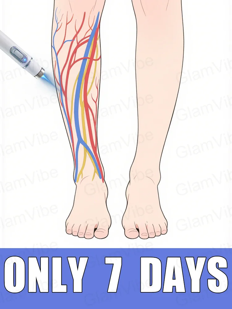 

blue light pen solve varicose veins, hot sale leg care tools