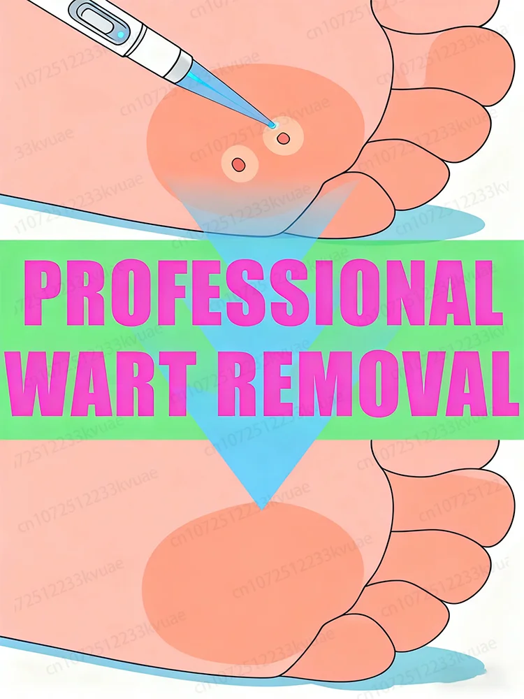 

ᴸᵃˢᵉʳ ᵖᵉⁿ ᵃᶜᶜᵘʳᵃᵗᵉˡʸ ʳᵉᵐᵒᵛᵉˢ warts without scarring or recurrence