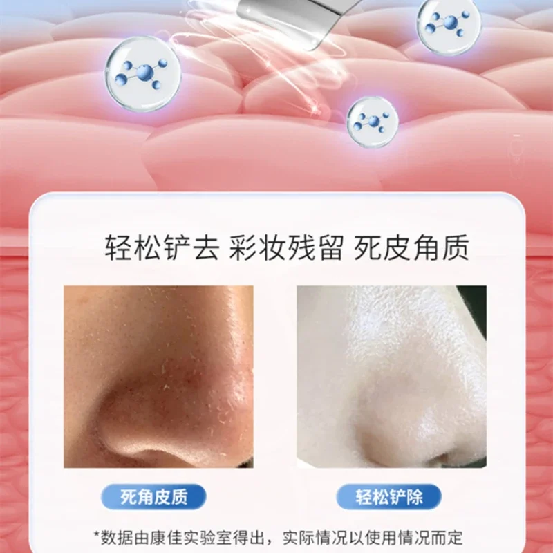 Free Shipping  Pore Cleanser Electric Razor Exfoliating Beauty Facial Pores Deep Cleansing Vibration