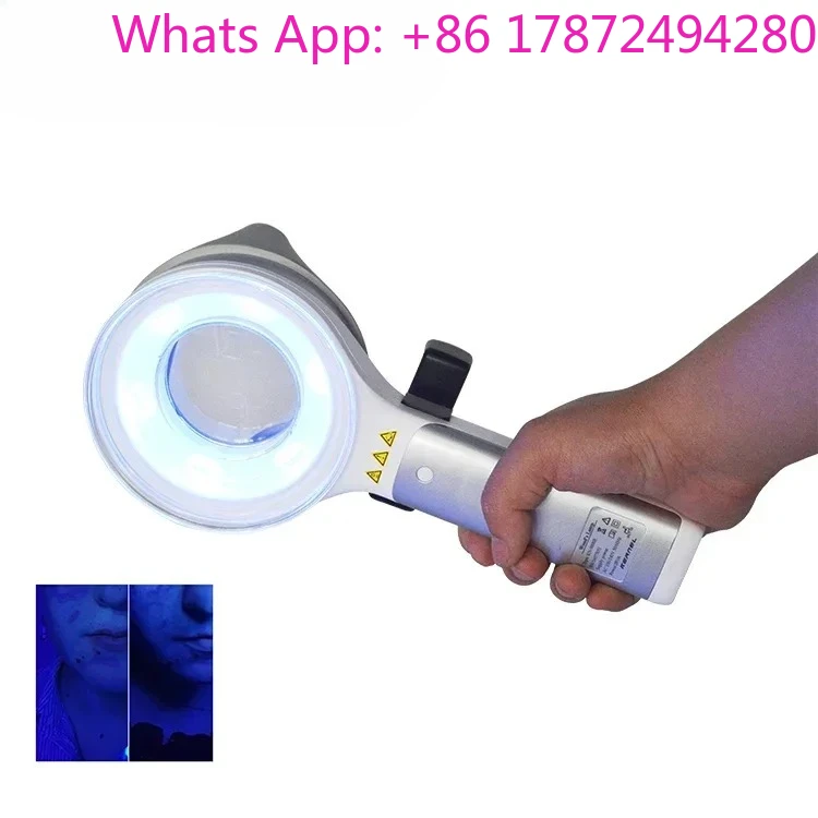 Skin Disease Test Examination KN-9000B 2025 Medical CE Approved UVA LED Combined Light Woods Lamp
