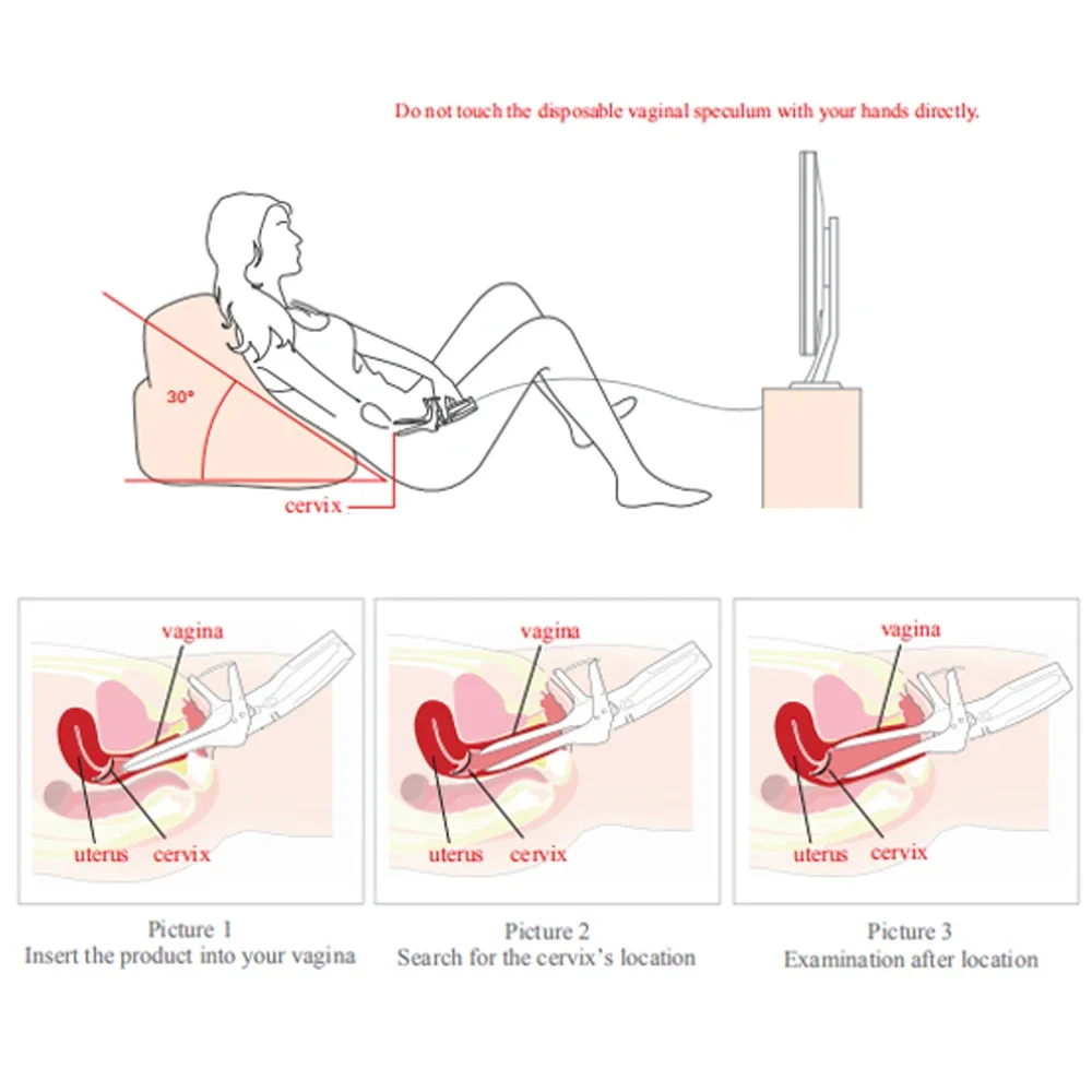 SINOHERO Mini Colposcope with Digital Video for Accurate and Convenient Health Monitoring Health Monitors Accessories