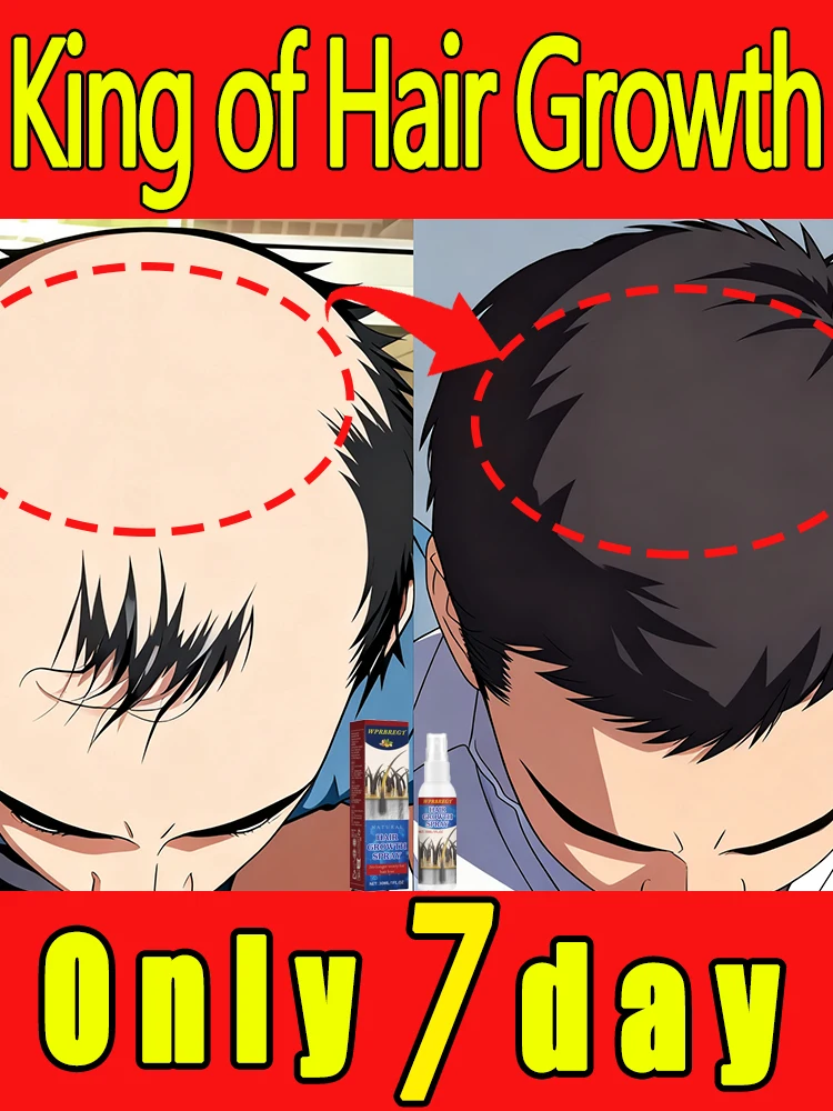 Intensief voedt de haarfollikels om de nieuwe groei te bevorderen, verbetert de hoofdhuidomgeving en versterkt de haarwortels