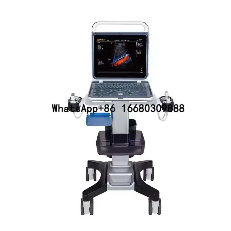 Full Digital Laptop Ultrasound 15-inch Screen Ultrasonic Scanner Machine  with High-resolution Image