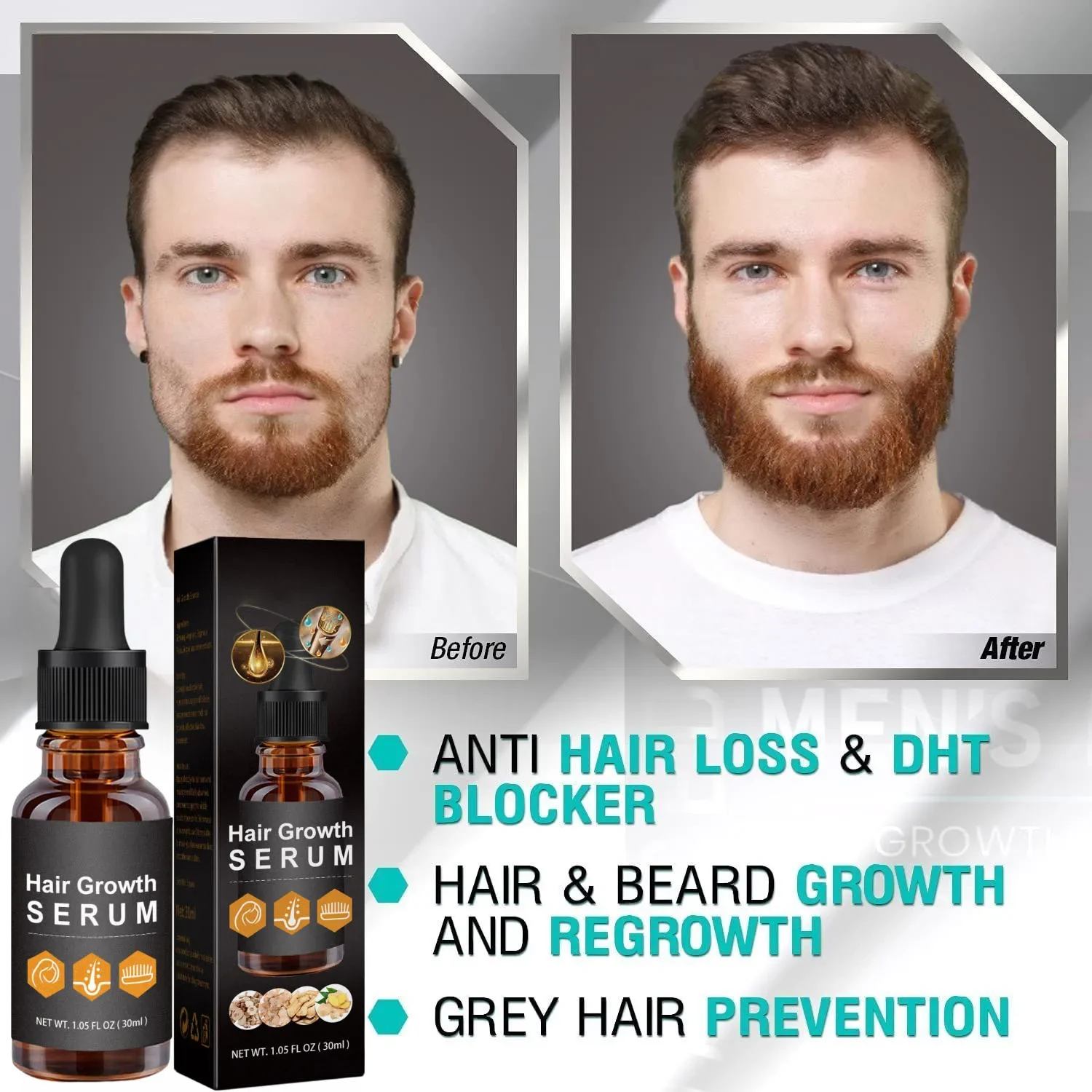 Óleo essencial para o crescimento do cabelo, óleo de cabelo rápido, homens e mulheres, eficiente, prevenir a perda de cabelo, tratamento do couro cabeludo, crescimento da barba, homens