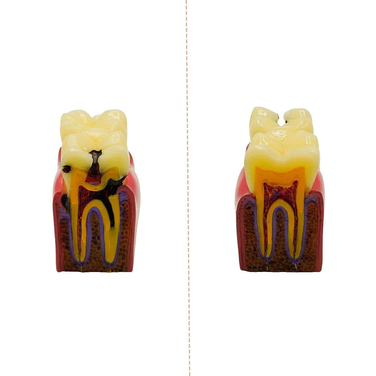 Thumbnail 3 - #7 Best Dental Teaching Models to Buy In 2026