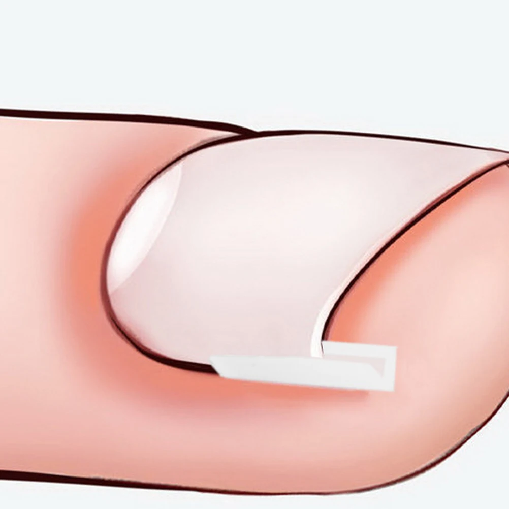 

Ingrown Corrector Pedicure Tools Curved Straightening Pad for Toe Correction Liner Paronychia Care Tool Ingrowing Nail Fixer