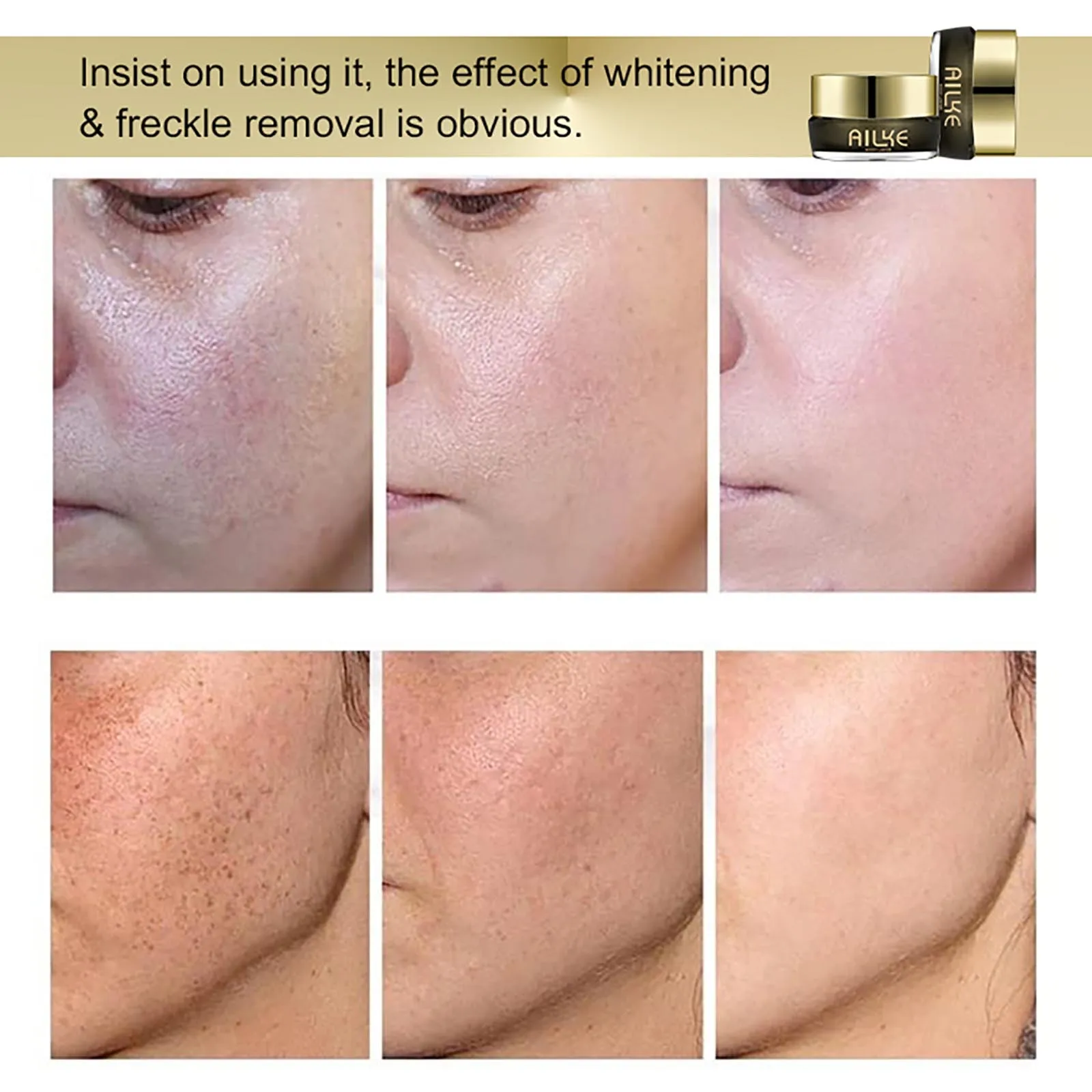 AILKE Whitening Face Cream, Reduce Dark Spots, Sun Spots, Inhibit Melanin, With Collagen, Glutathione, For All Skin Types
