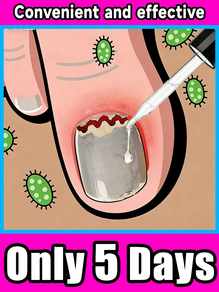 

Professional Blue Light Nail Therapy Device for Problem Nails, Rechargeable Home Beauty Tool