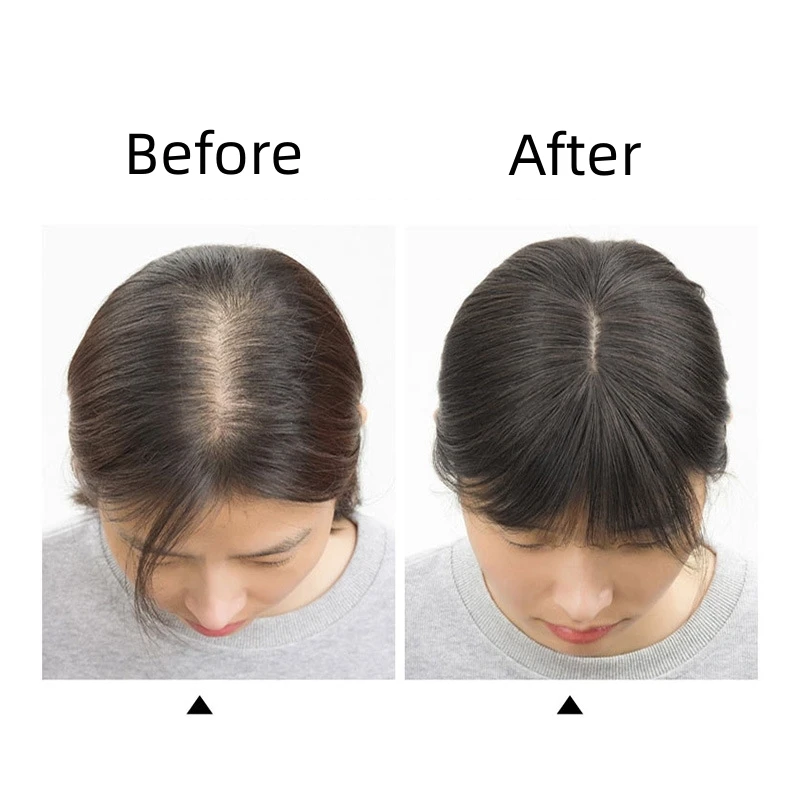 T-part Slik Lace Human Hair Toppers for Women Clip-In Topper with 3D Air Bangs Fringe Hairpieces for Women Thinning Hair Loss