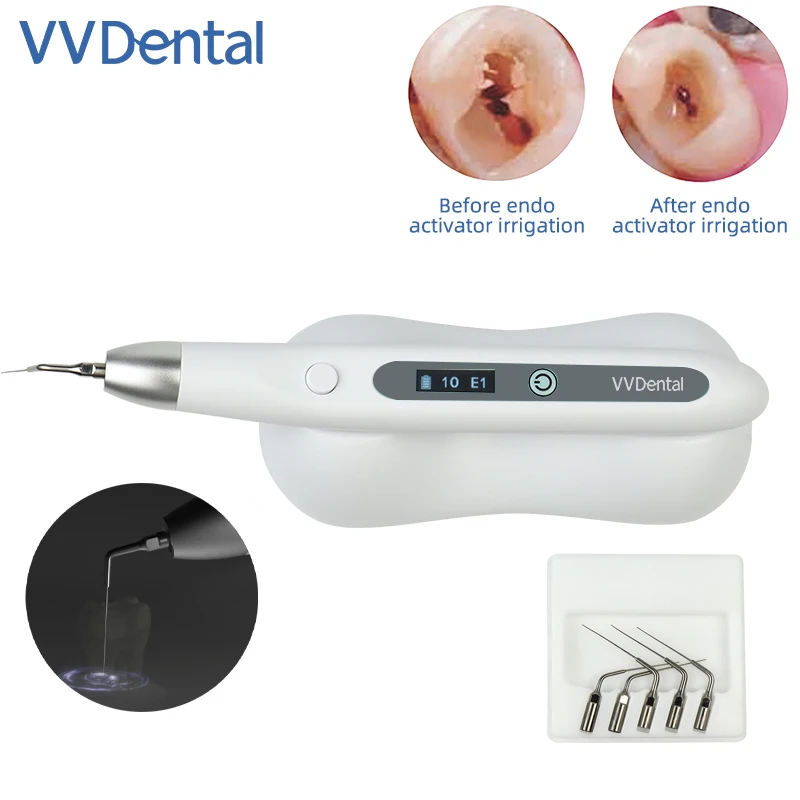 VVDental Dental Sonic Endo Irrigator Activator for Root Canal Cleaning And Calcified Stain Removal Ultrasonic Irrigator