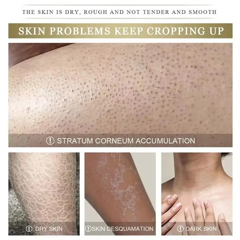 Reduce Chicken Skin Cream Repair Acne Hair Follicles Shrink Pores Fade Body Melanin Whiten Smooth Moisturize Skin Beauty Health