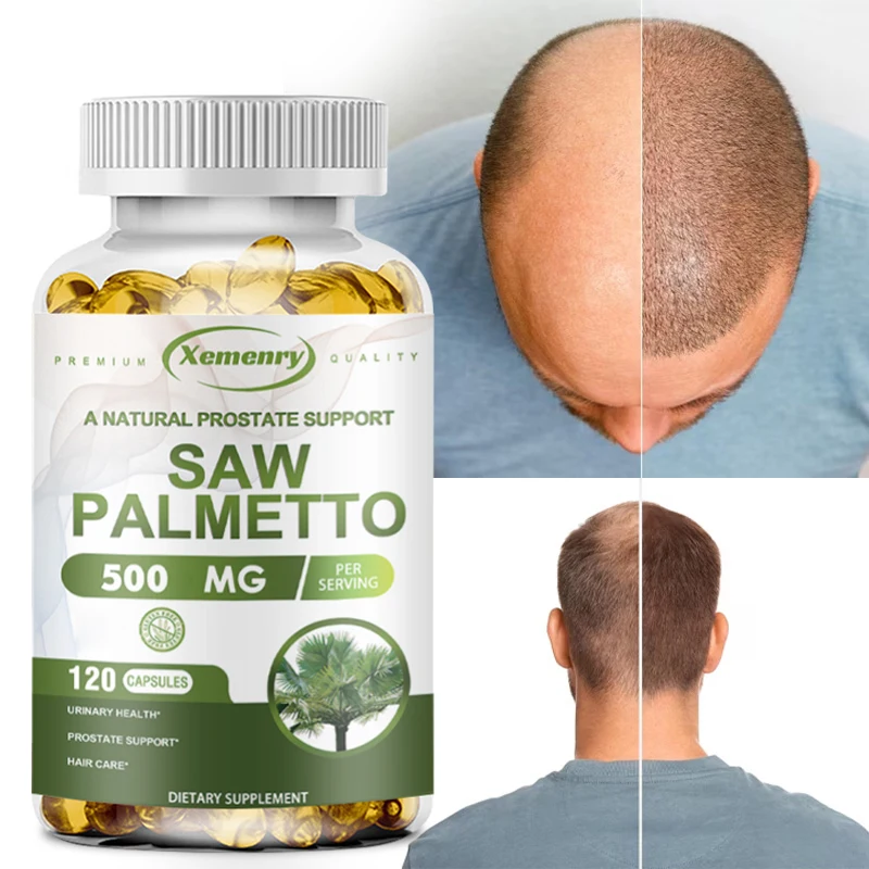 Men's Premium Prostate Health and Hair Loss Support Supplement, Cápsulas Nutricionais de Saw Palmetto, Aids micção, 5000 mg