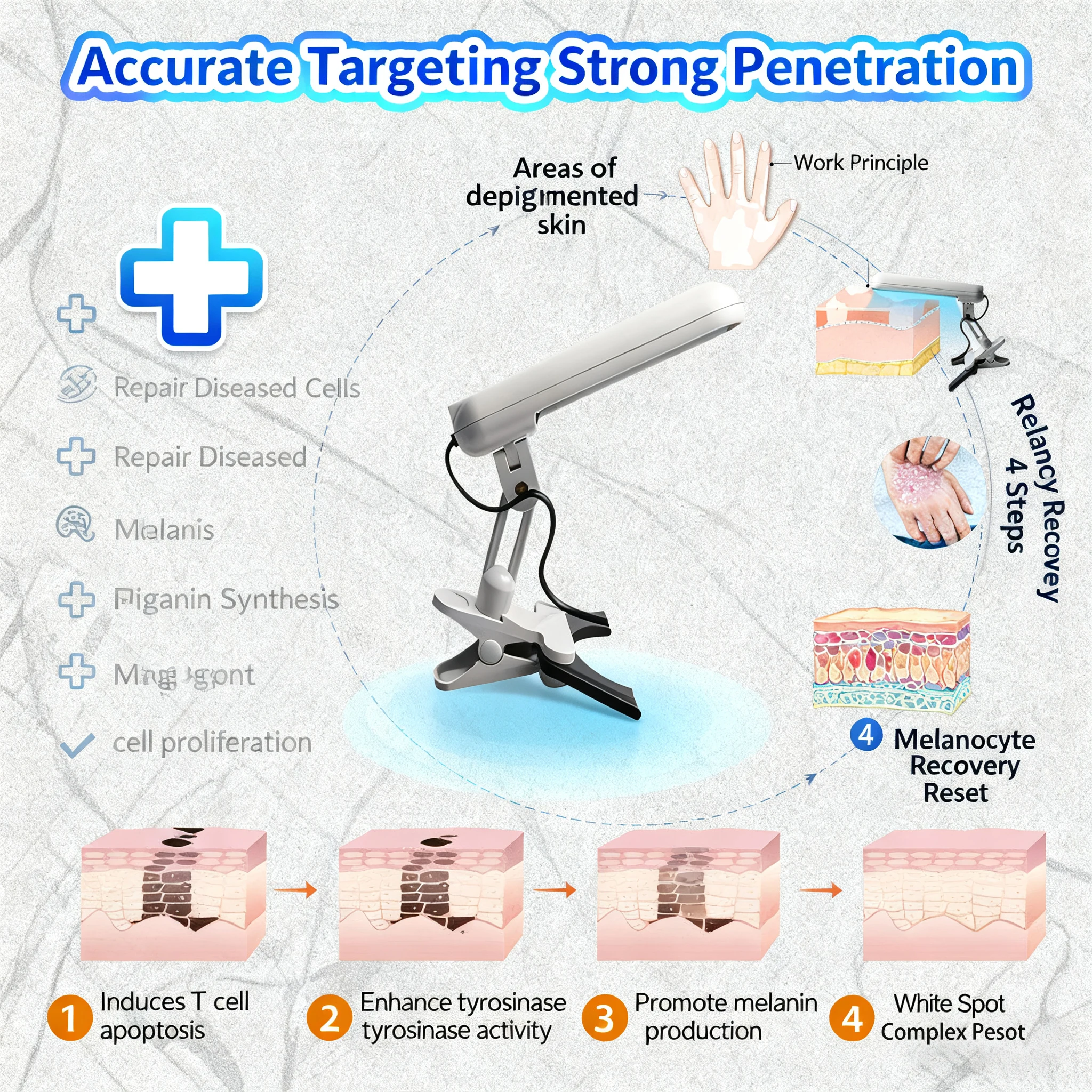 Instrumento de terapia de banda estrecha UVB de 311nm, lámpara de fototerapia UV para lámpara de terapia de Vitiligo, tratamiento de enfermedades de la piel de la Psoriasis en el hogar