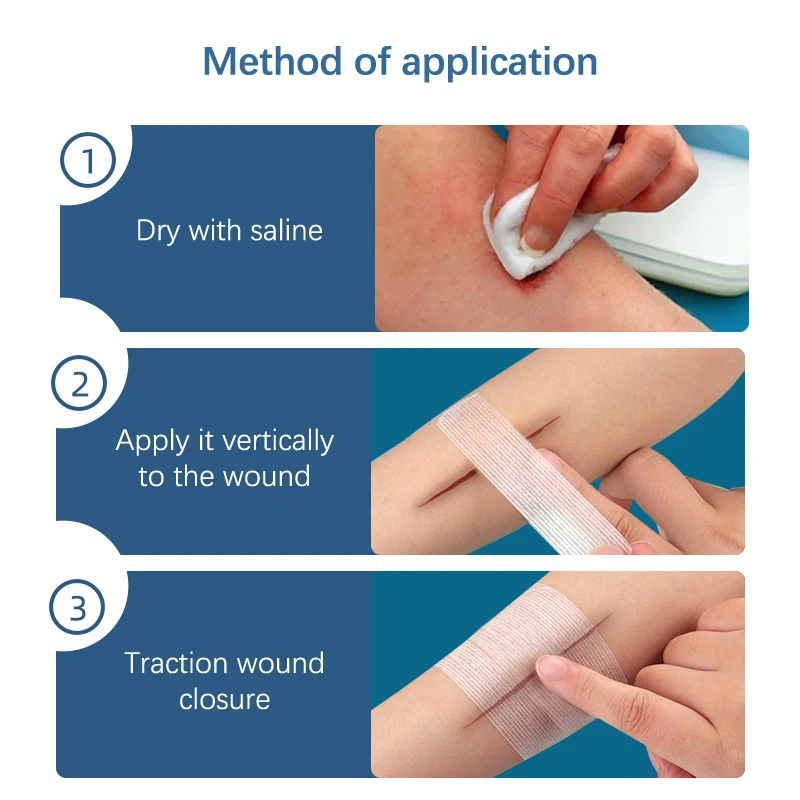 

2/3/5Pcs Sutureless Wound Adhesive Bandage Skin Patch For Children Adults Sticking Plaster
