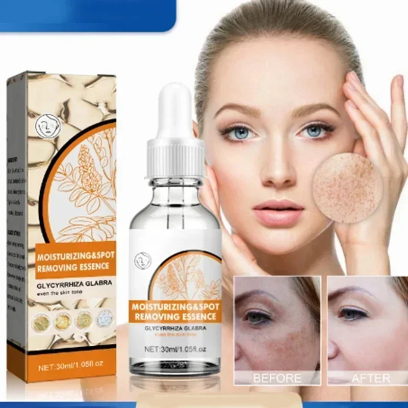 Niacynamid Dark Spots Remover Serum Freckle Whitening Moisture Powerful Removal Black Dot Melasma Chloasma Face Skin Care Cream