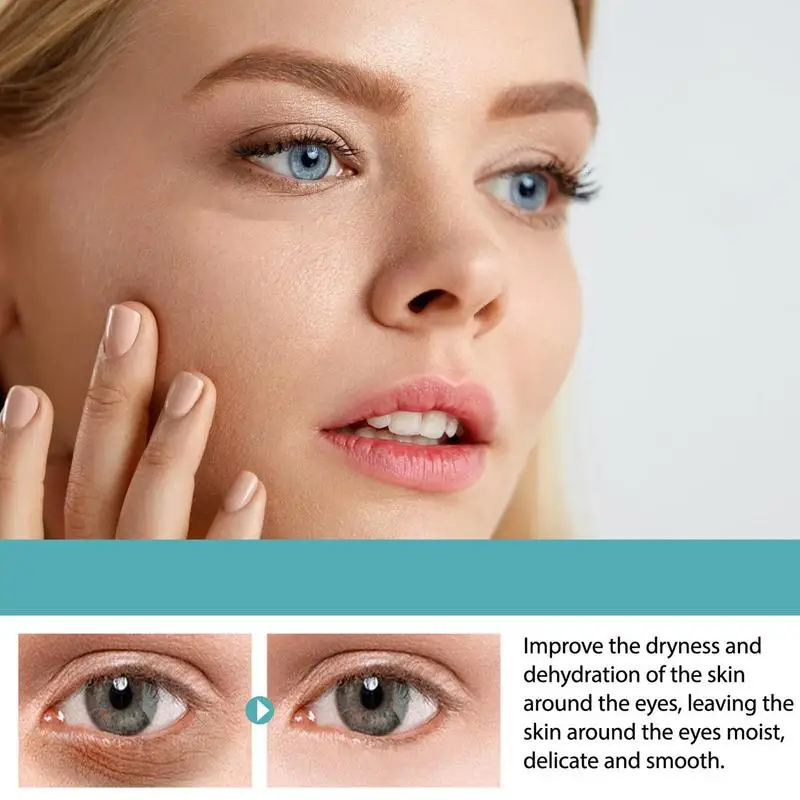 Crème anti-cernes instantanée pour les yeux, crème anti-âge sous les yeux, élimine les poches sous les yeux, les poches, lifting, dodu, optimiste, resserre la peau, 5 pièces par ensemble