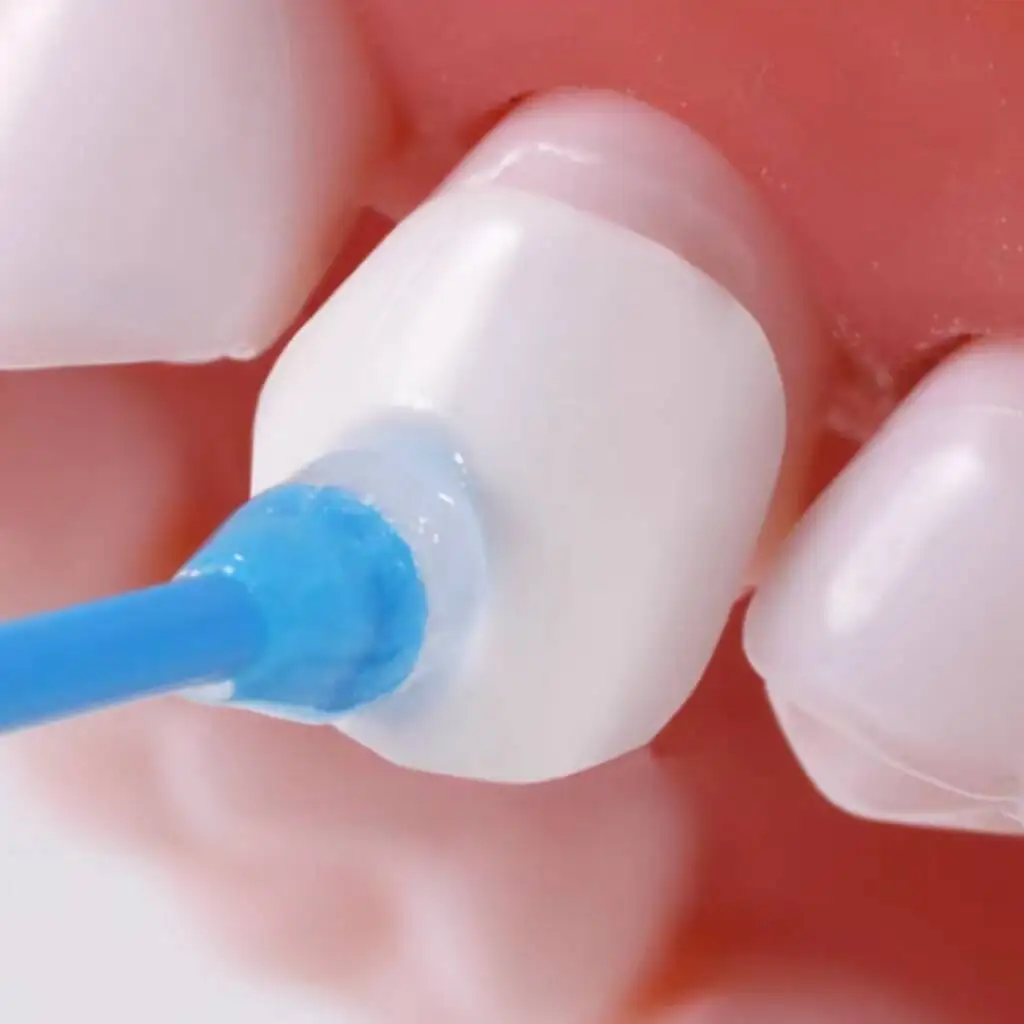 Disposable Dental Adhesive Tip Micro Applicator Sticks for Tooth Crown Porcelain Veneer Bonding Rods Dentistry Materials