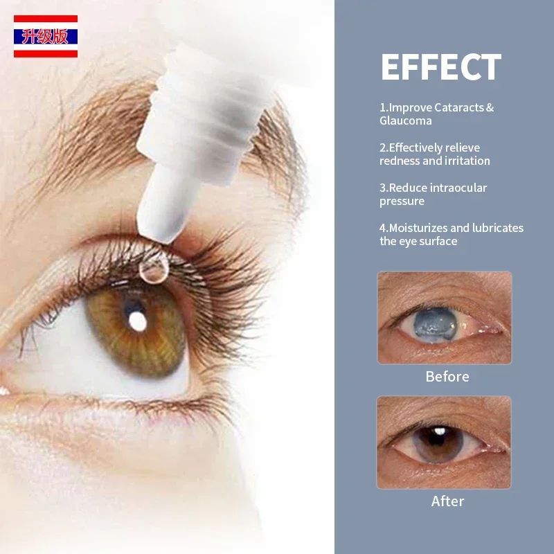 Cataract Removal Treatment Medicine Eye Drops Apply To Pain Dry Itchy Eyes Fatigue Blurred Vision Cleaner Thailand Formula