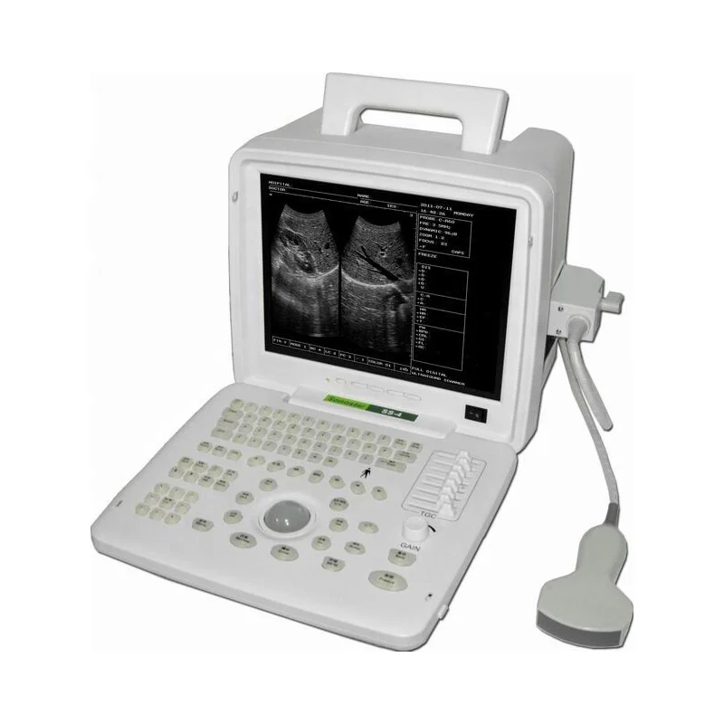 Portable B-mode Ultrasound Machine B scan device Portable B-mode Ultrasound Machine