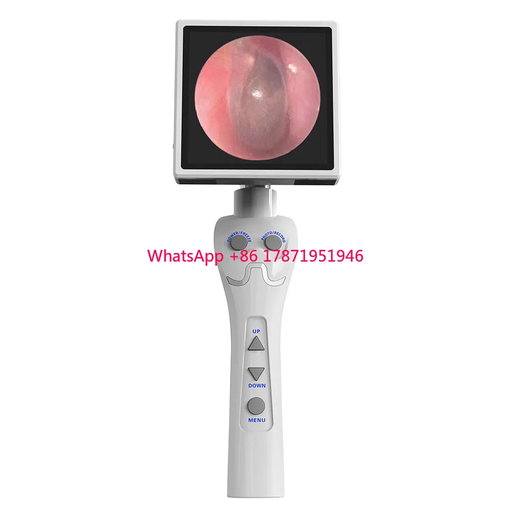 China Portable Medical Digital Video ENT Endoscopy Display System with LCD Camera