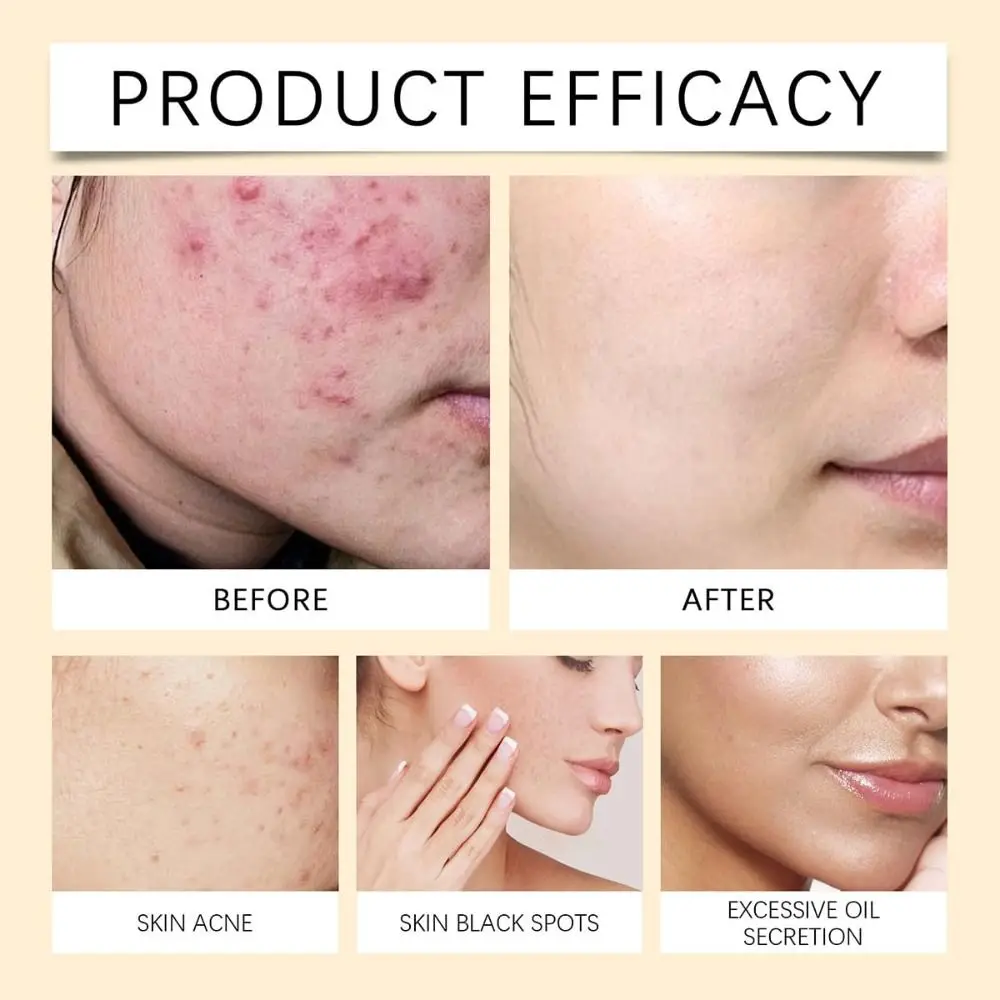 Hot Ground Rice Rice Gezichtsmaskers Honing Glow Hydraterende Huidverzorging Voedende Porie Talg Gezichtscrème voor Gezichtsverzorging