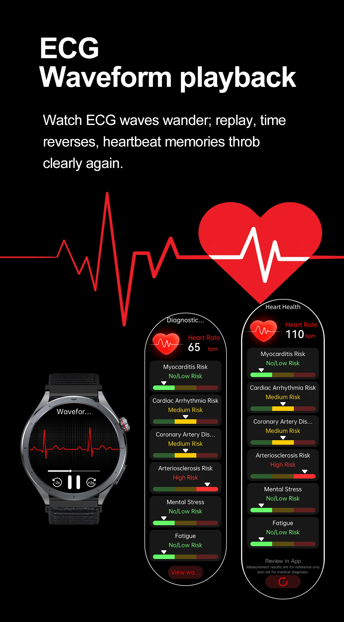 2026 Neue Körperfettanalyse Gesundheits-Smartwatch EKG+PPG Harnsäure Blutdruck Blutsauerstoff Uhr Anruf-Smartwatch für Männer Frauen – Detail 9