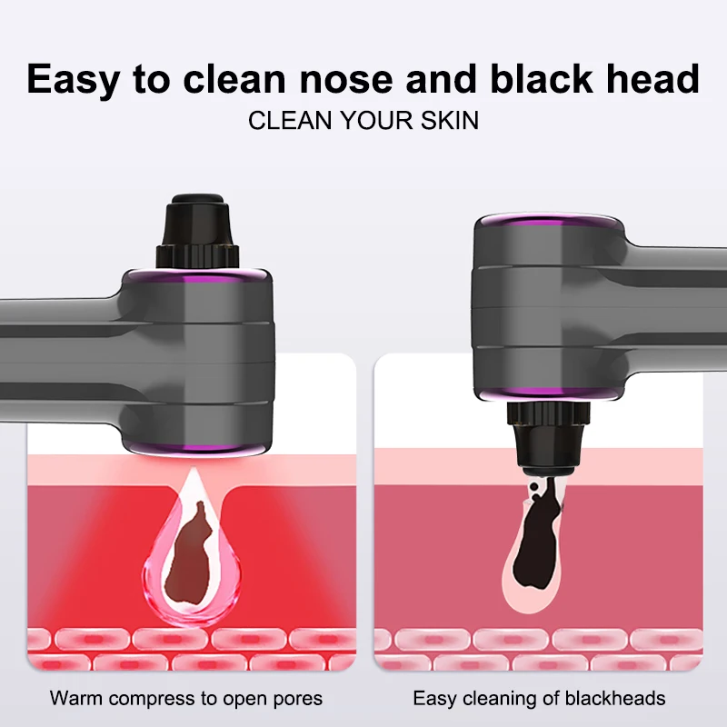 VLVEE Elektrische Comedondrukker Gezichtsreinigingsmachine Pore Cleanser Handheld Mee-eter & Acne Remover huidverzorging Tool