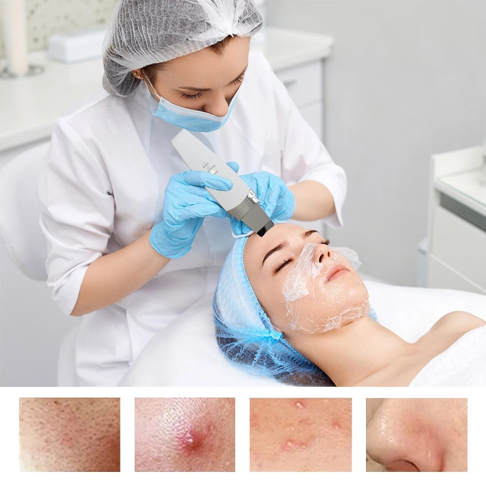 Nueva espátula limpiadora de piel ultrasónica Facial, eliminador de espinillas, limpieza Facial profunda, máquina de elevación, pala peladora, limpieza de poros