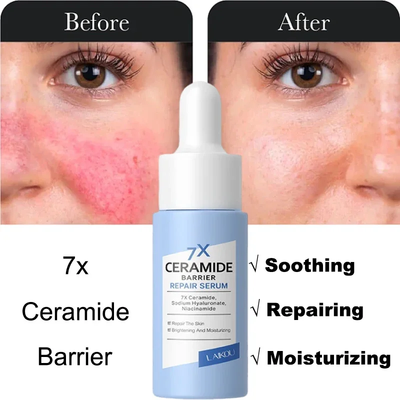 7X Facial Redness Soothing Serum Instant Rosacea Red Blood Vein Treatment Improve Sensitive Skin Barrier Repair Korean Cosmetics