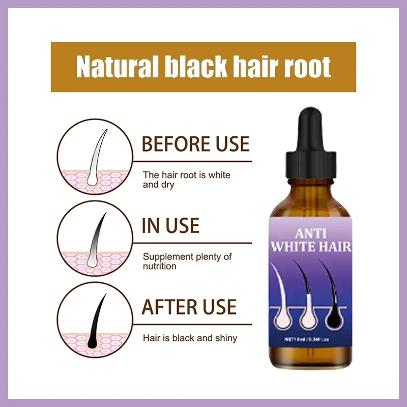 Grey Hair Repairs Serum White hair treatment essence turns white  into natural black