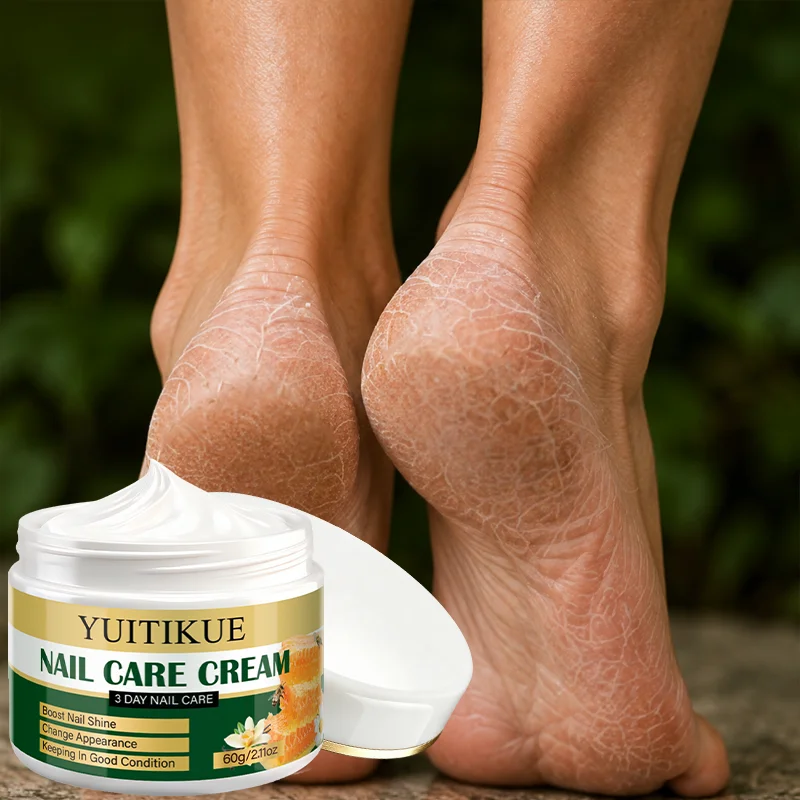 YUITIKUE Exfoliating Urea 42% Foot Cream, Hydrating Foot Lotion To Smooth Dry Flaky Heel Skin For Men Women