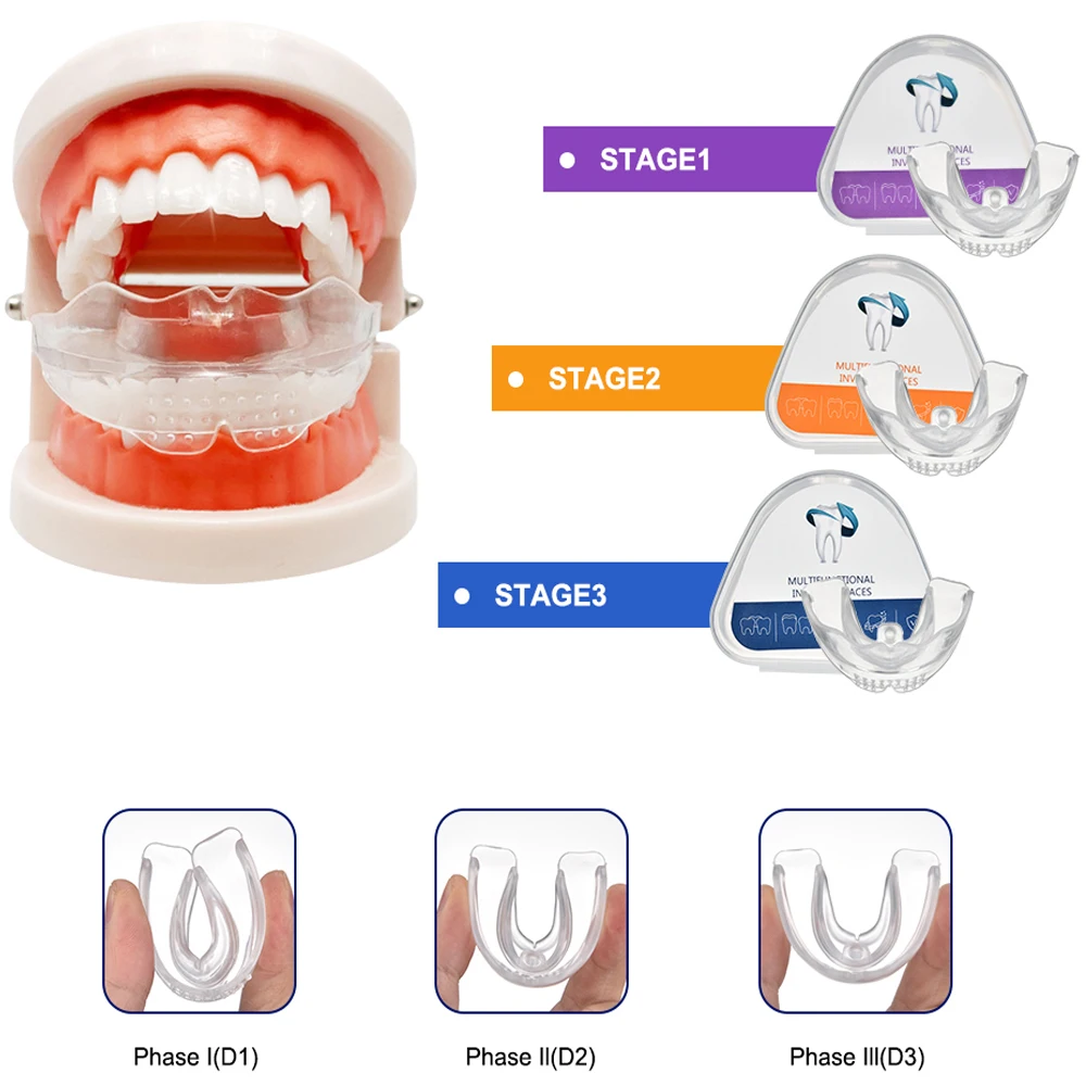 

3-ступенчатые ортодонтические брекеты, стоматологические брекеты, тренажер для выравнивания зубов с улыбкой, мгновенный силиконовый фиксатор зубов, прозрачный корректор
