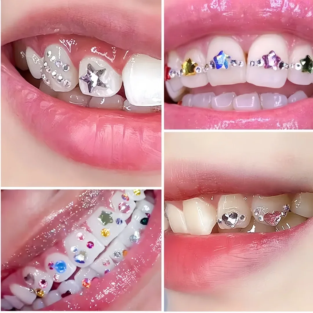 1pc Dental Decoration Glue No Damaging Tooth Gem Adhesive Tooth Jewel Glue for Dental Crystal Oral Use Jewelry Fixing Adhesive image 5