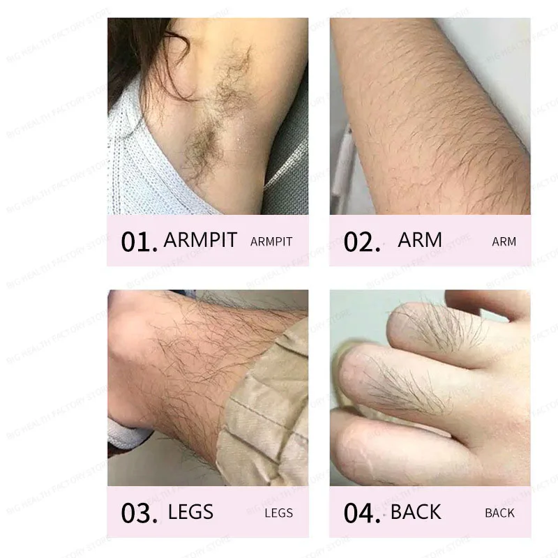 Depilatory cream for men and women, removes hair from underarms, private areas, arms, back of hands, and legs without leaving residue