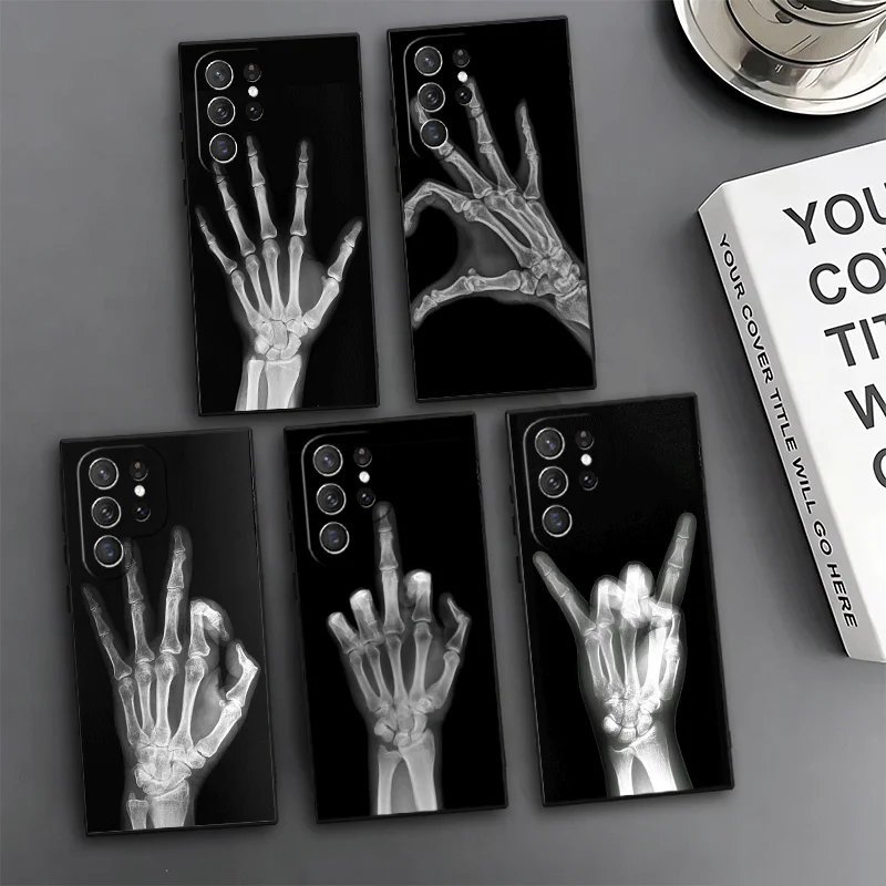 Funny X-Ray Hand Bones Phone Case For Samsung Galaxy S24 S25 S26 Ultra S23 Plus S22 S21 FE S20 + Edge Pattern Customized Cover