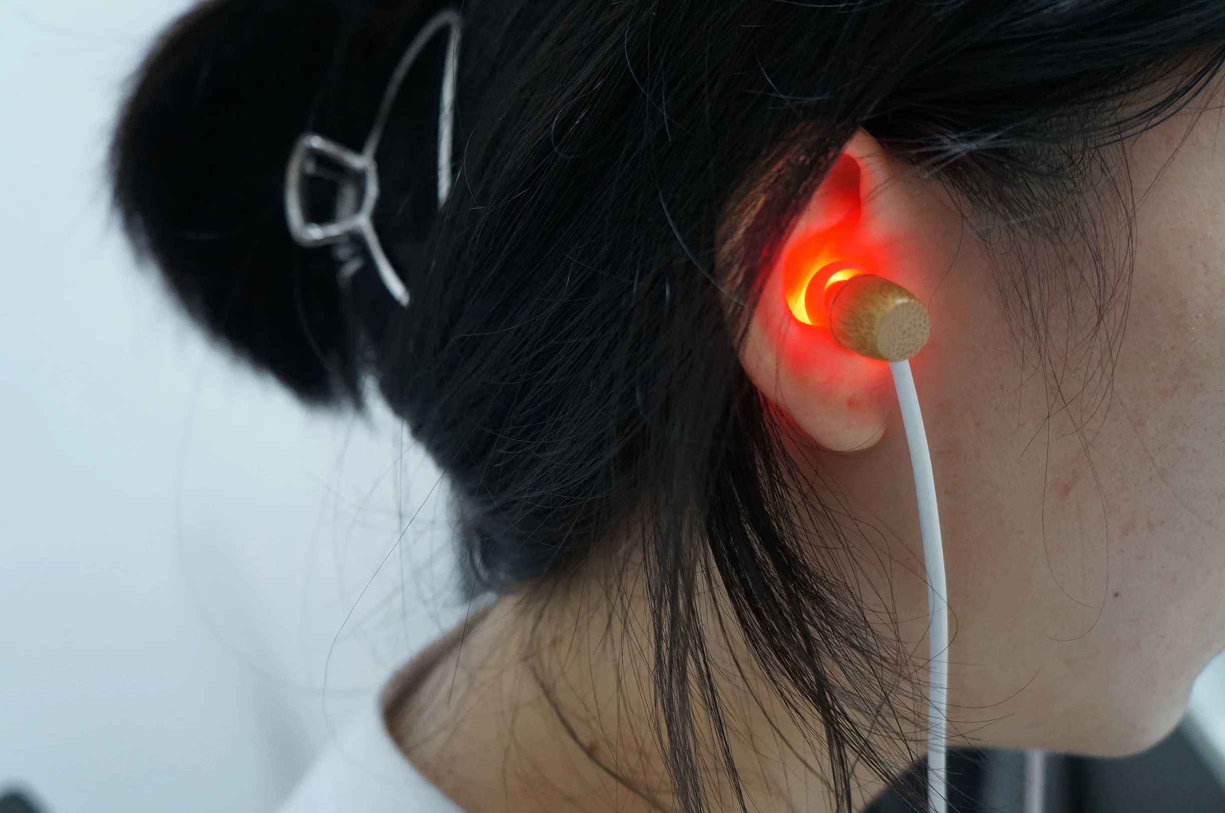 Tinnitus Ear Laser Therapy, LLLT Irradiação, Fisioterapia, Earplug, Oftálmica Media, Surdez, Diabetes, Hipertensão Tratamento