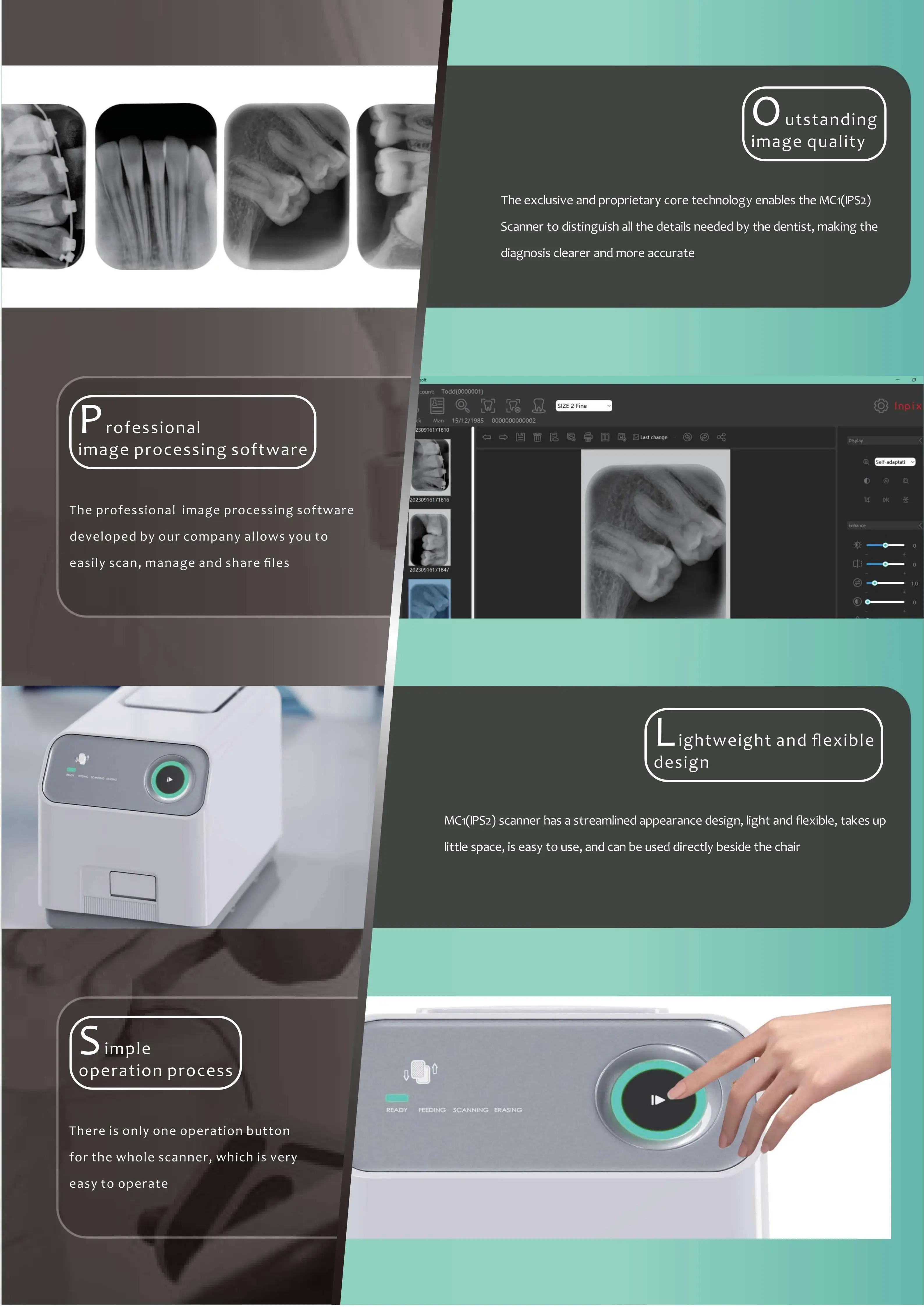 وافق CE ISO عالي الدقة 17lp/mm ماسح لوحة صورة PSP للأشعة السينية للأسنان #3