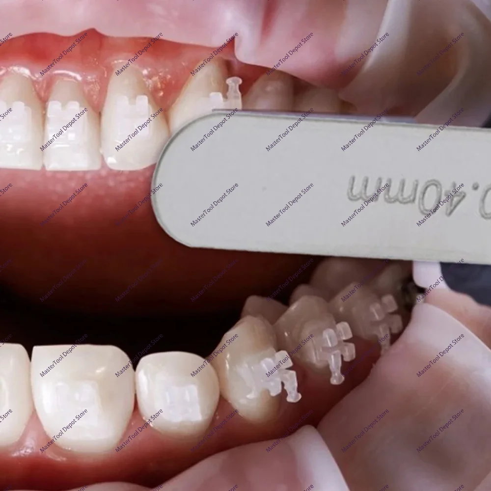 0.1 - 0.5 Mm Stainless Steel Gap Measuring Ruler - Tooth Gap Measurement - Tooth Interproximal Space Reduction Ruler