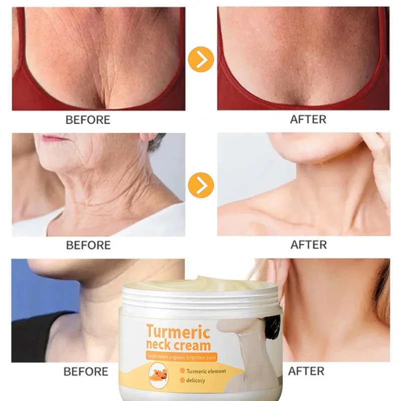 Crema eficaz para el cuello de cúrcuma, Reduce el doble mentón, desvanece las líneas finas, antiarrugas, blanqueamiento firme, ilumina los productos para el cuidado de la piel del cuello