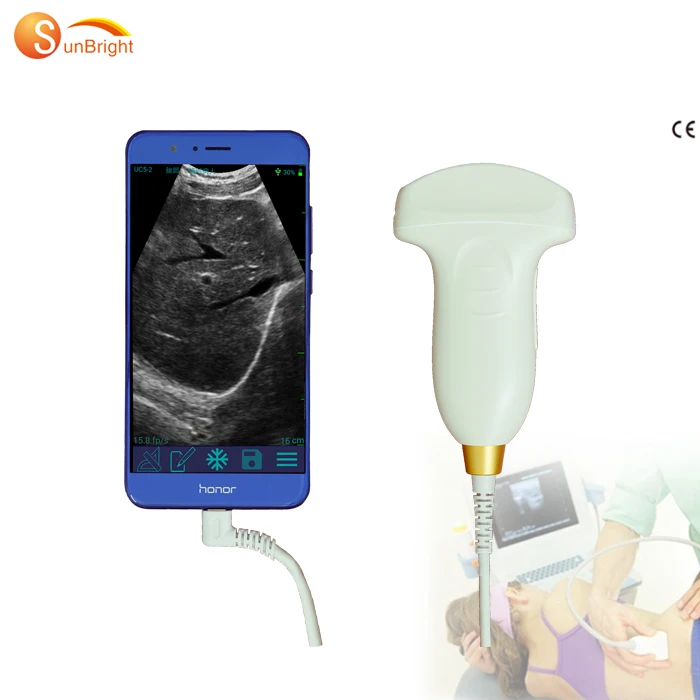 

USB Ultrasound Probe Mini USG Device Probe Ultrasonido Scanner Convex Probe