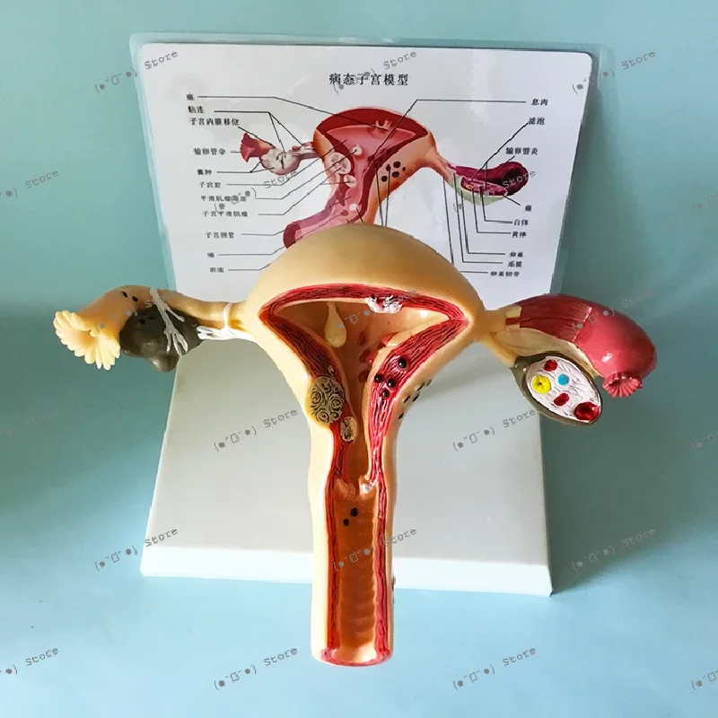 

uterus model genital female organ anatomy human teaching instruments medical teaching aids