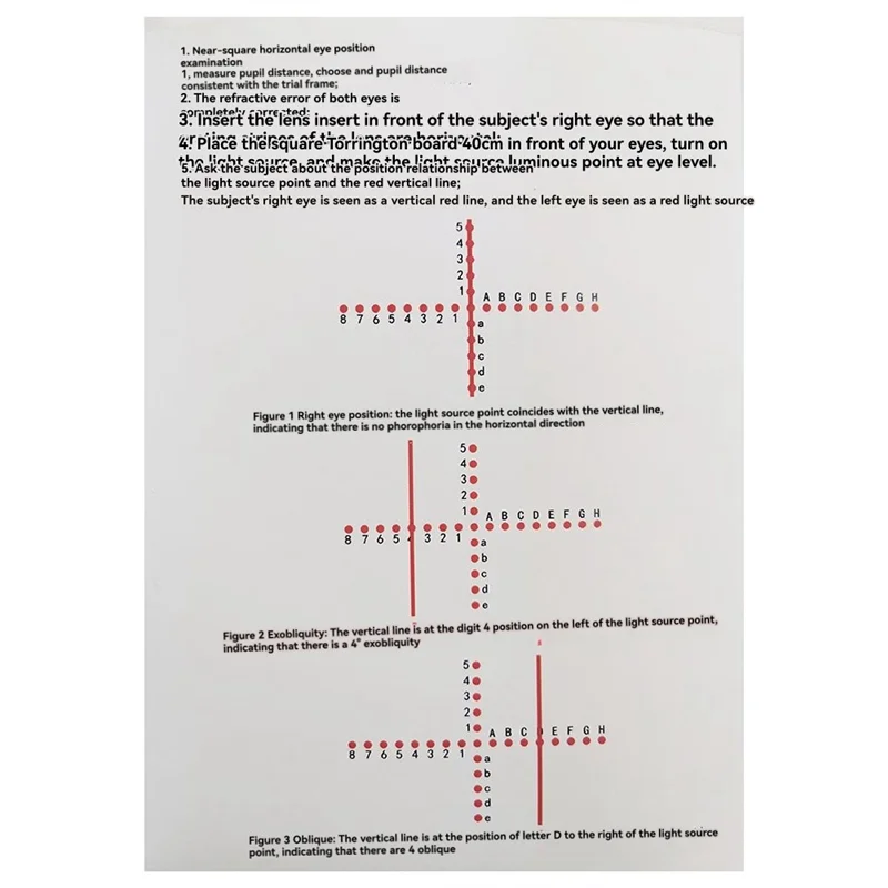 

ABRS-Trabismus Detection Tool AC/A Ophthalmic Strabismus Detection Tool Fornear-Eye Position Screening