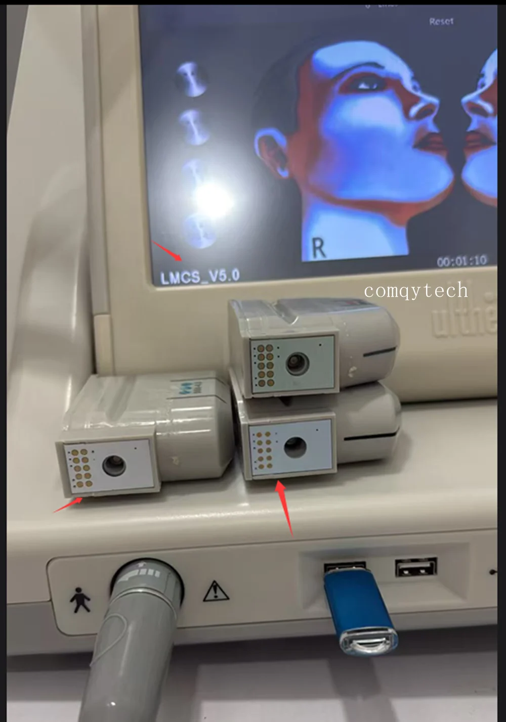 Version V5.0 10000 Schuss Gesi – Hifu Machine Cartridge 1.5 3.0 4.5 Bewertung und Preis