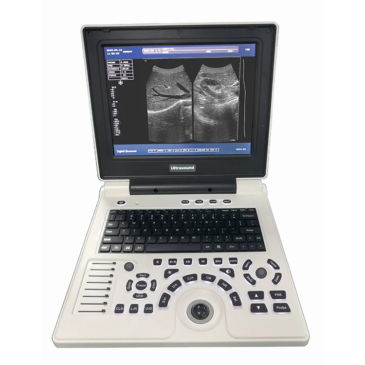 XF30B VET Full Digital Laptop Scanner Veterinary Portable Ultrasound Physiotherapy