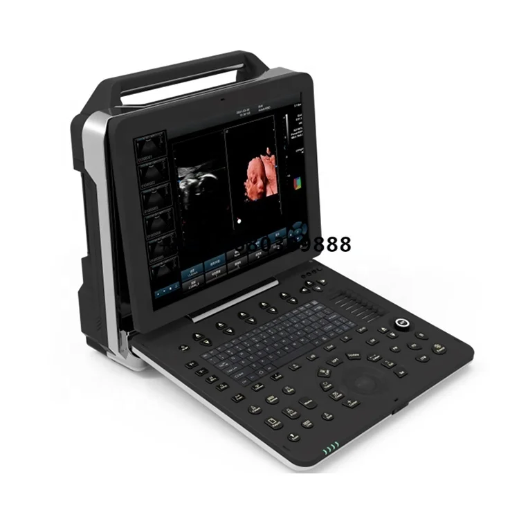 Medical Device Color Doppler Diagnostic Ultrasonic Sonography Machine Portable Ultrasound